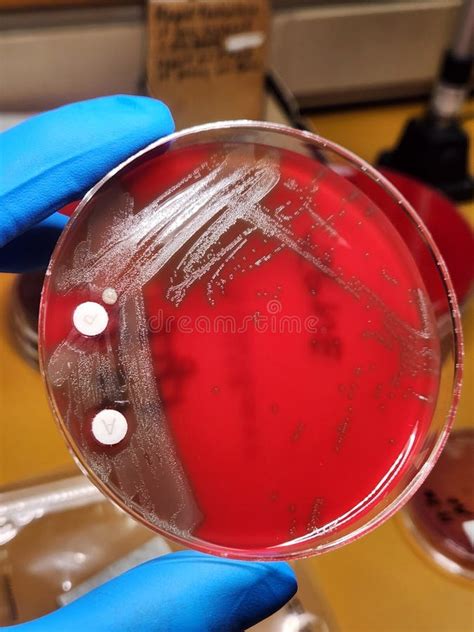 strep pneumoniae test on blood agar put drops of|strep pneumoniae hemolysis.